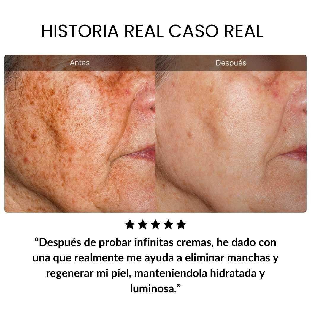 crema antiedad sangre de dragón